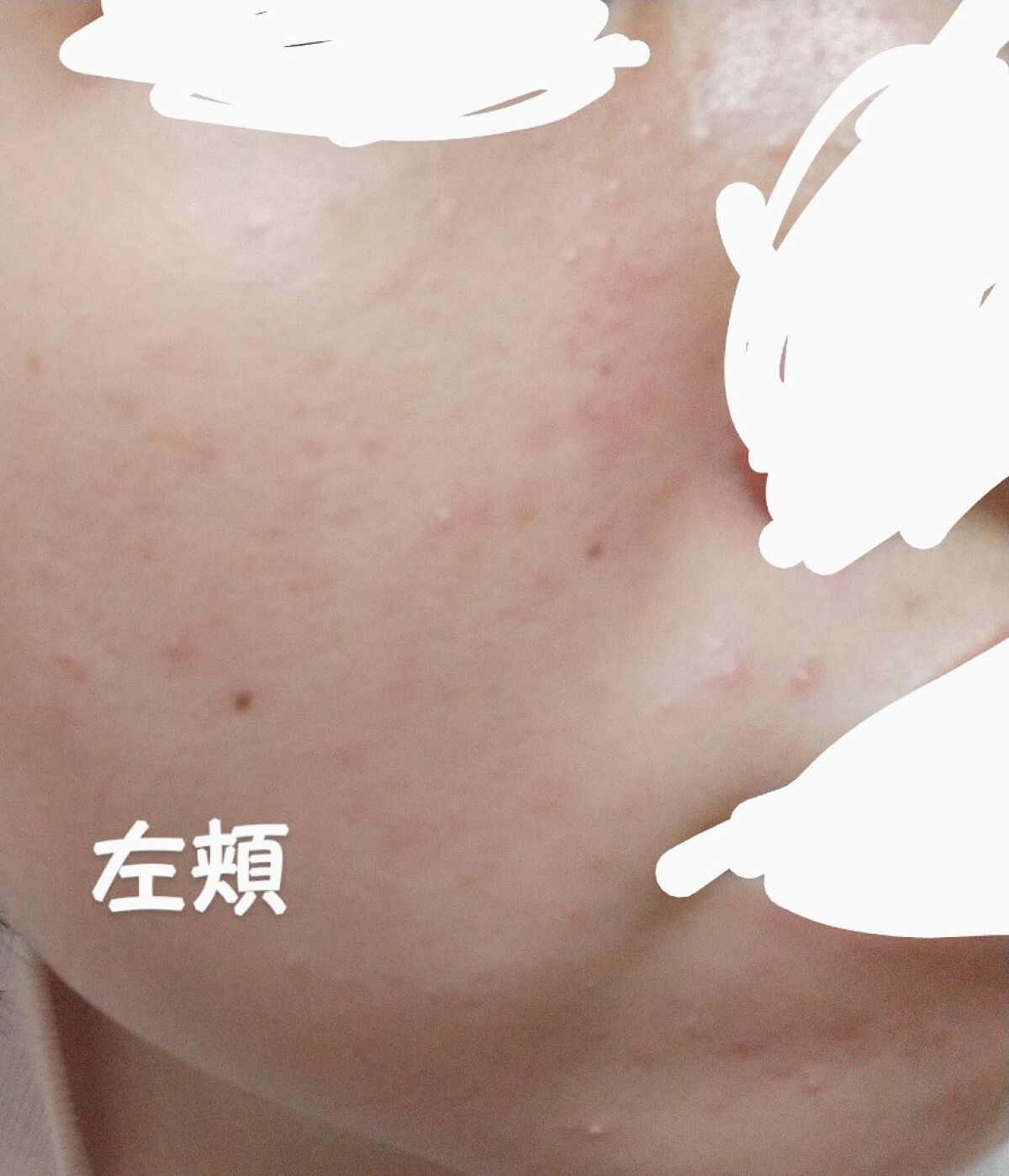 ソフティモ ディープ クレンジングオイル/ソフティモ/オイルクレンジングを使ったクチコミ（2枚目）