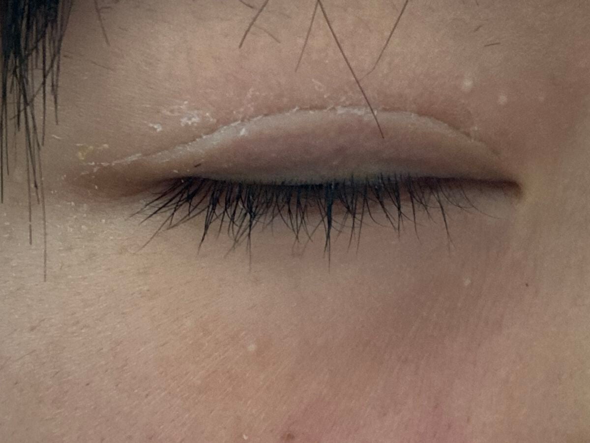 coral_perfume_n6f7 on LIPS 「ダイソーのアイプチをやるとこうなりますなのであまりおすすめはで..」(2枚目)