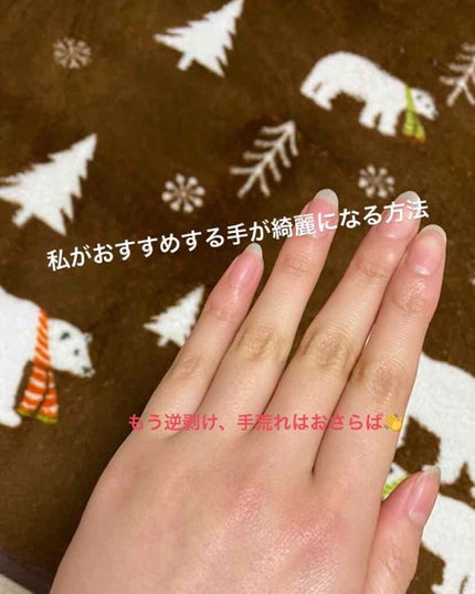 ニベアクリーム/ニベア/ボディクリームを使ったクチコミ(1枚目)