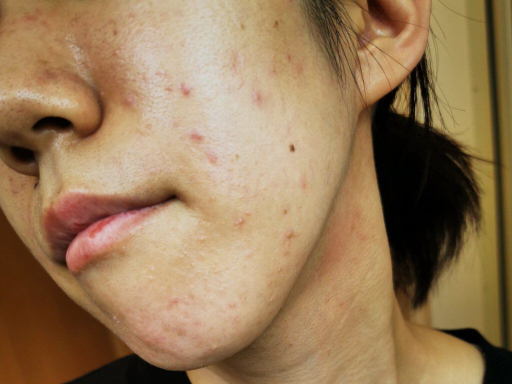 薬用美白ファンデーションSPF50+/ONLY MINERALS/ルースパウダーを使ったクチコミ(5枚目)