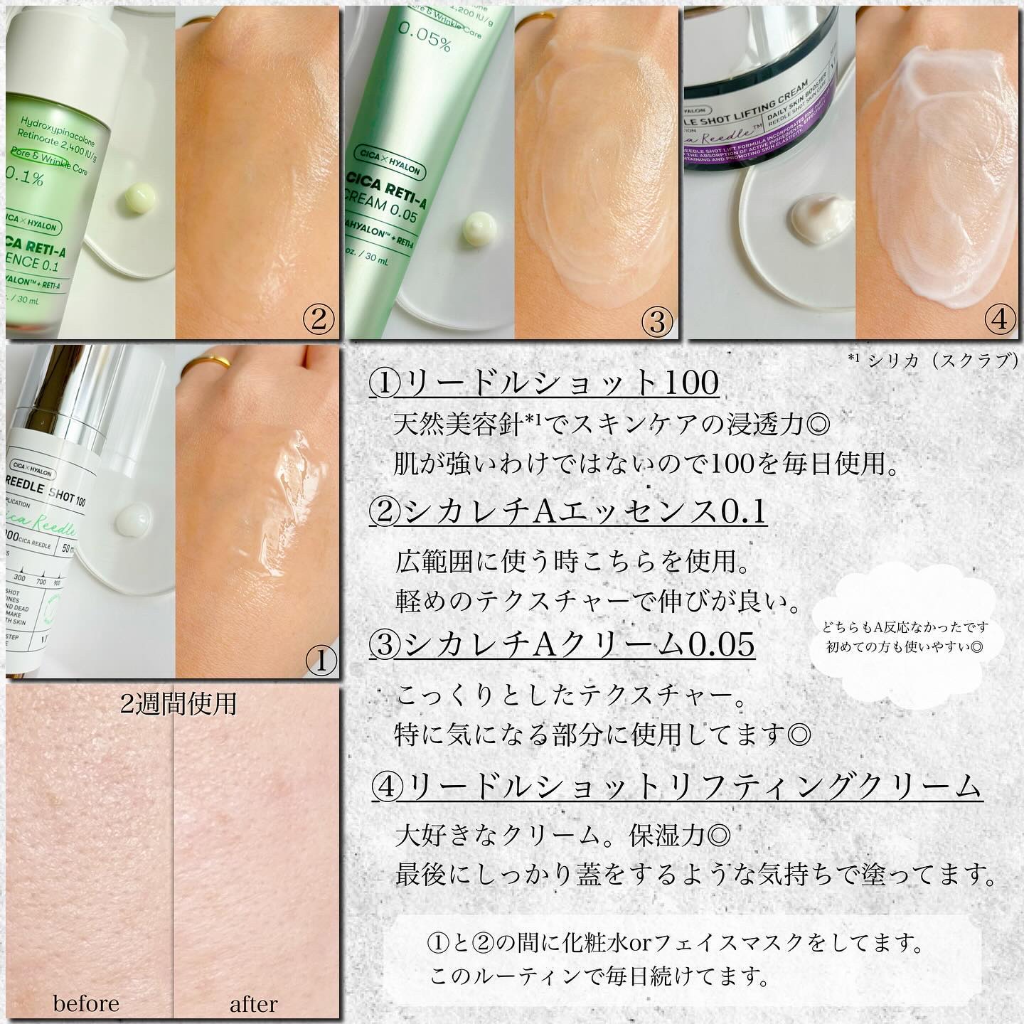 シカレチA エッセンス0.1/VT/美容液を使ったクチコミ（2枚目）