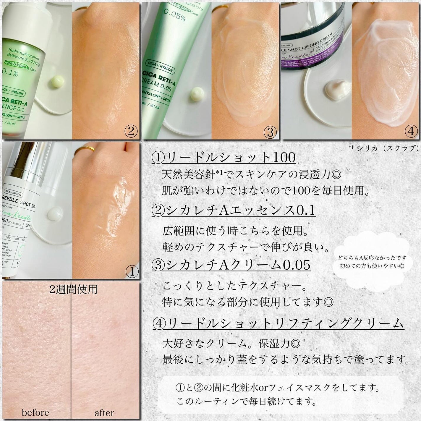 シカレチA エッセンス0.1/VT/美容液を使ったクチコミ(2枚目)