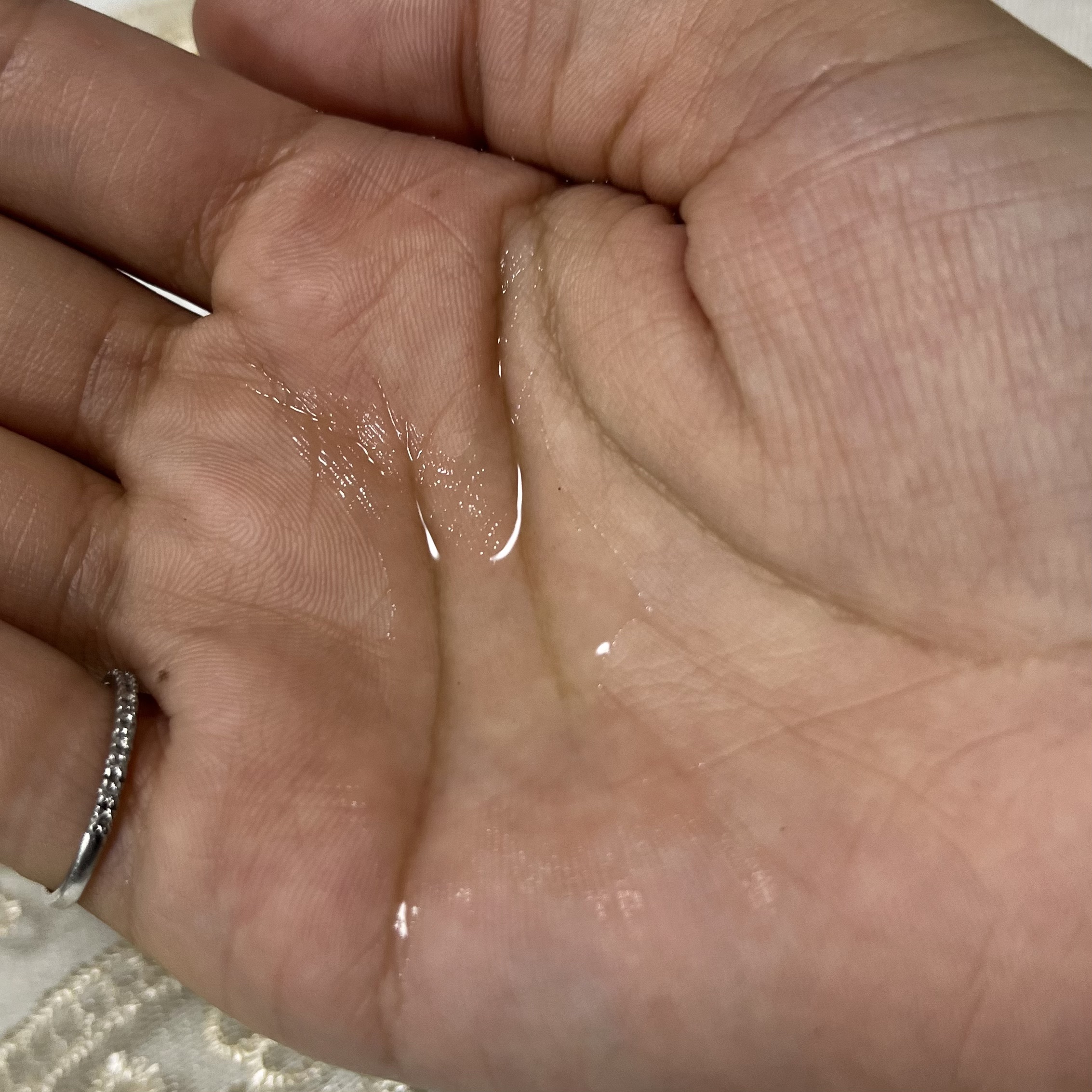 スカルプローション/Rintor/頭皮ローションを使ったクチコミ（3枚目）