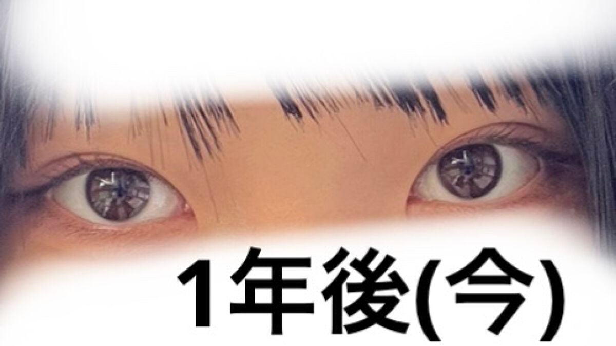 べあ@sjk on LIPS 「春休み真っ只中、整形シーズン!ということで普段投稿あまりしない..」(10枚目)
