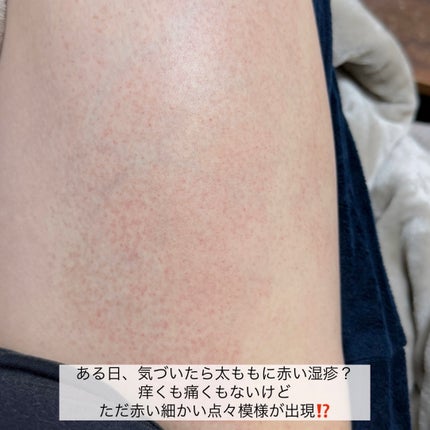 ジョンソン ベビーオイル 無香料/ジョンソンベビー/ボディオイルを使ったクチコミ(4枚目)