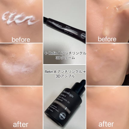 Retin A アンチ リンクル3Dクリーム/theralogic/フェイスクリームを使ったクチコミ(4枚目)