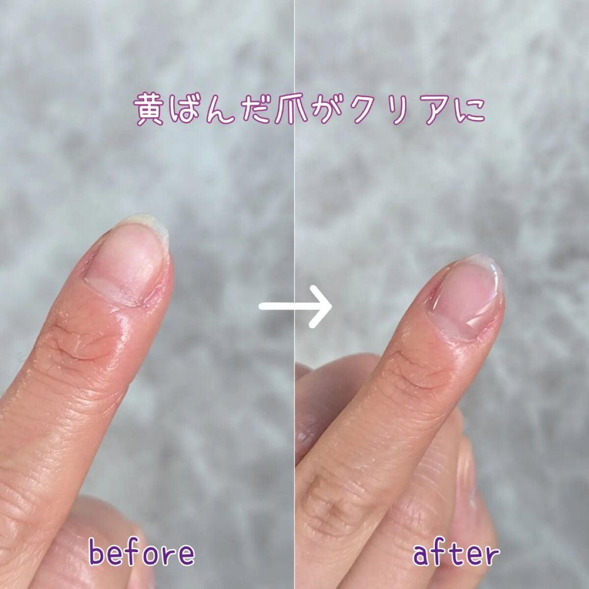 グロスフォーユアネイル/プレビュート/オールインワンネイルを使ったクチコミ(2枚目)