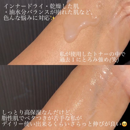 パンテトイン エッセンス トナー/manyo/化粧水を使ったクチコミ(2枚目)