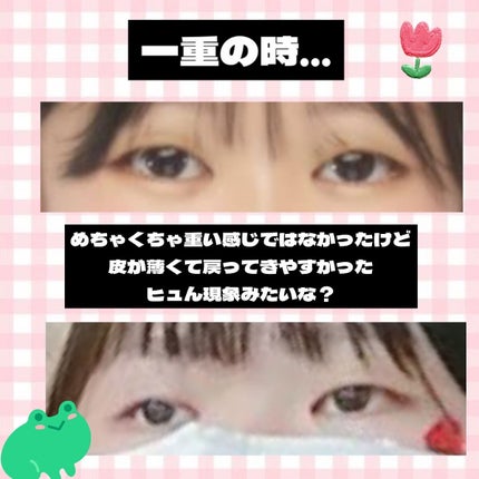 資生堂ベビーパウダー(プレスド)/ベビー/ボディパウダーを使ったクチコミ(2枚目)