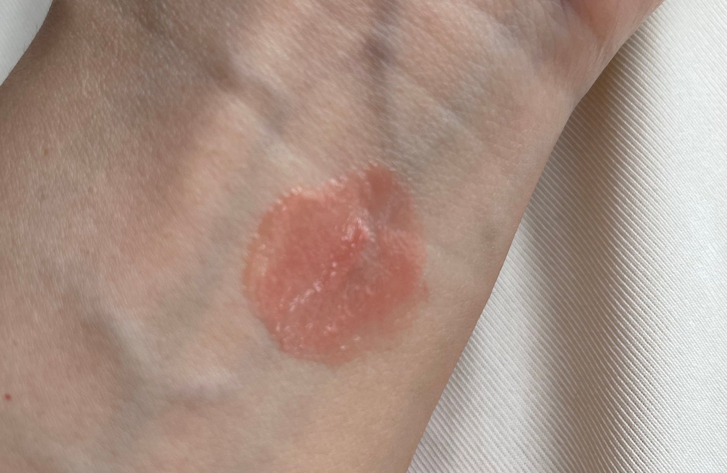 メンソレータム リップフォンデュ/メンソレータム/リッププランパーを使ったクチコミ(4枚目)