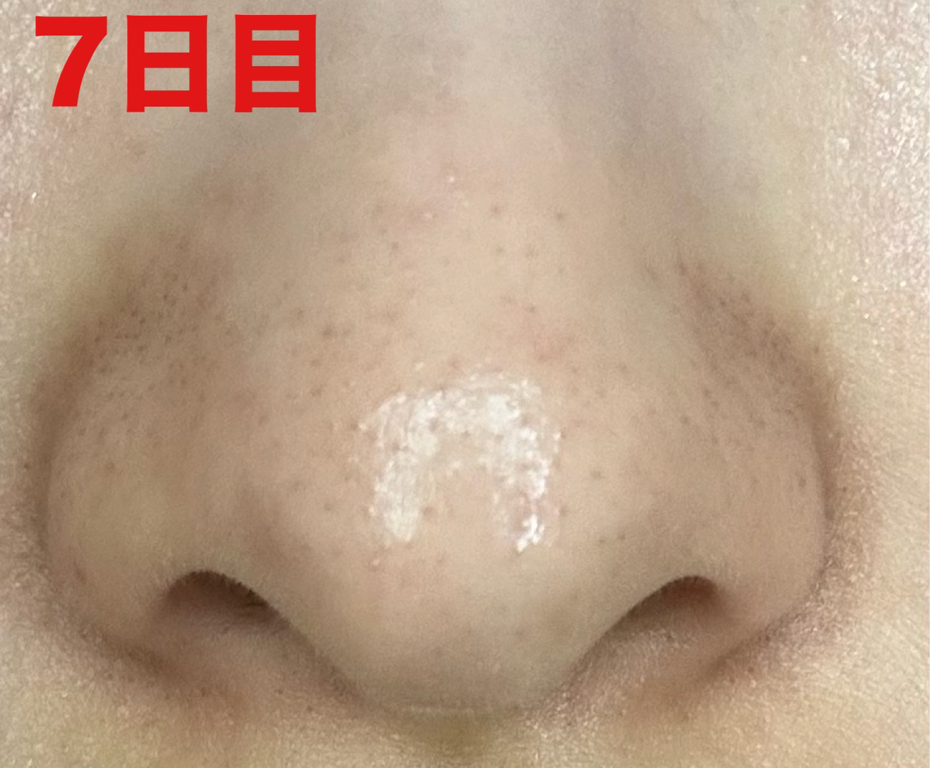 ディープクリア酵素洗顔	/メラノCC/洗顔フォームを使ったクチコミ（3枚目）