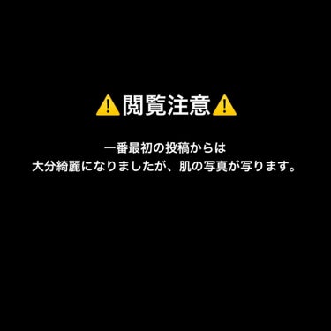 ぽてと on LIPS 「お久しぶりです！！！ぽてとと申します🙇‍♀️🙇‍♀️前回の投稿..」（1枚目）