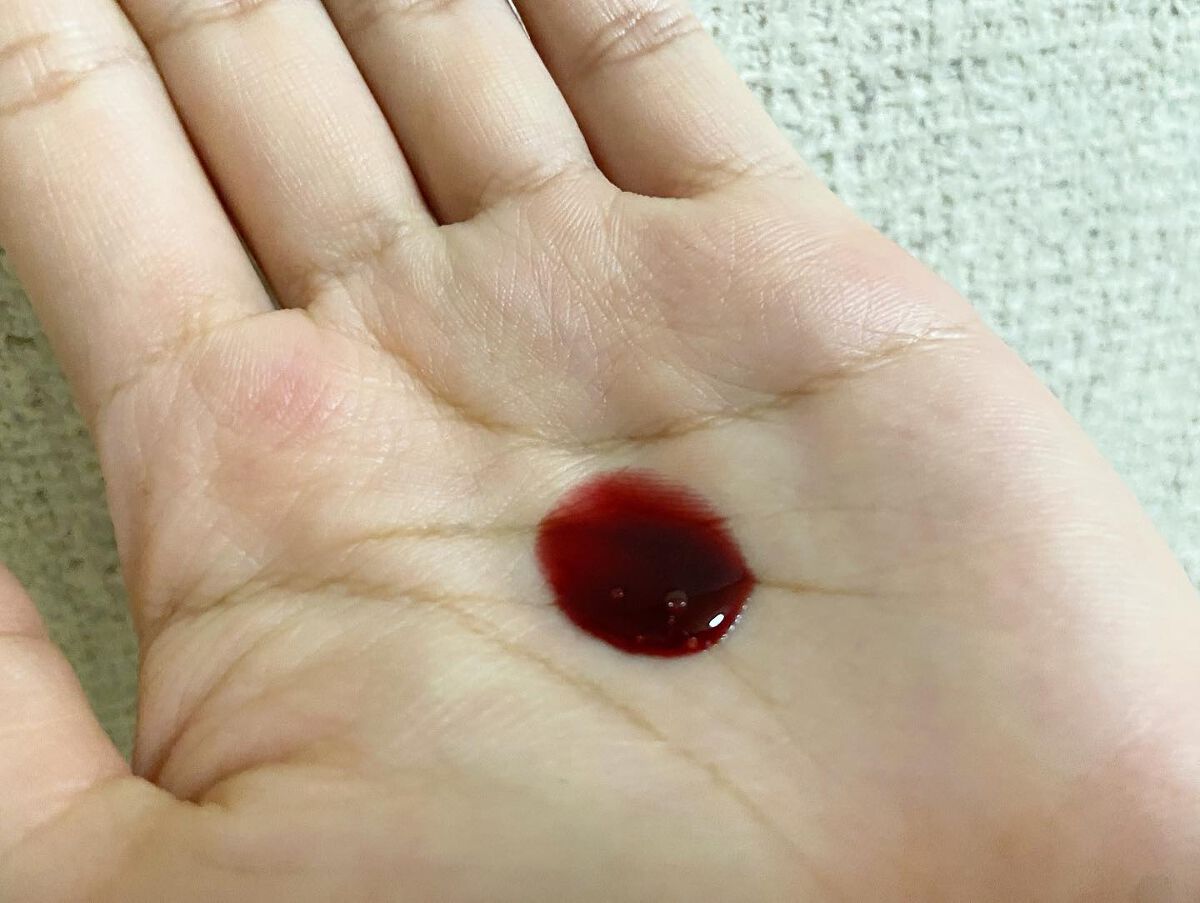 AHA 30% + BHA 2% Peeling Solution/The Ordinary/ピーリングを使ったクチコミ（3枚目）