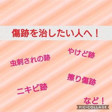 皆さんこんにちは！

今回はアットノンをご紹介したいと思います！

                                     --------ｷﾘﾄﾘ線--------
♡クリームなので