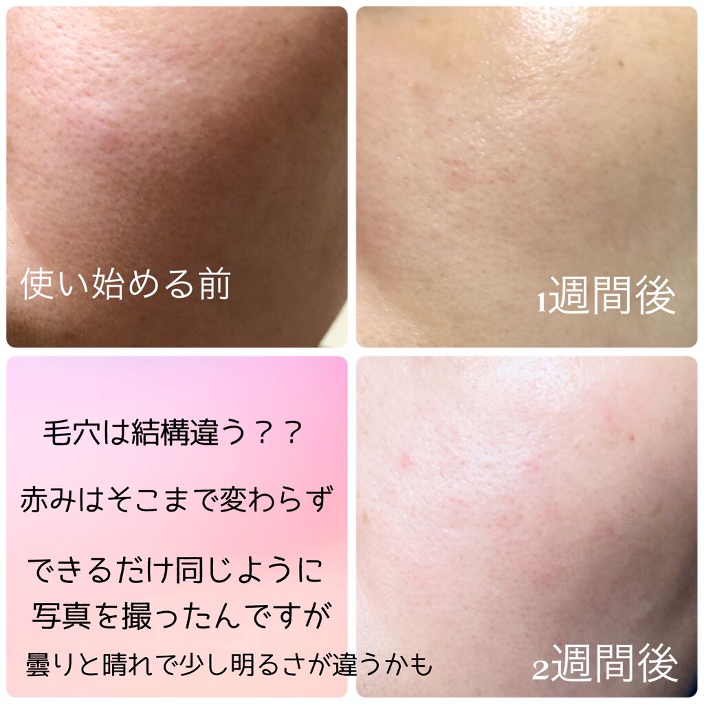 ラスターリッチクリーム/shimaboshi/フェイスクリームを使ったクチコミ(4枚目)