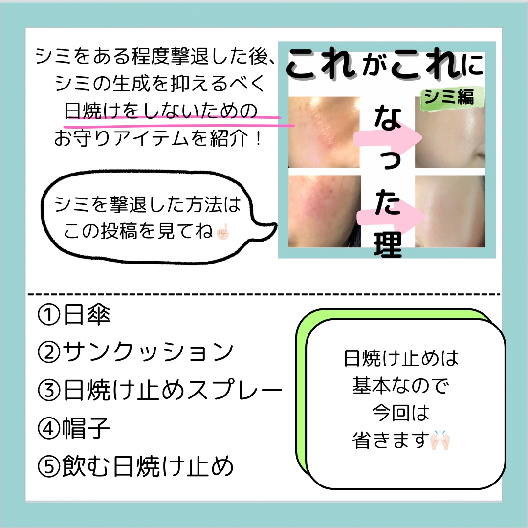 100%完全遮光 日傘/Rose Blanc/日傘を使ったクチコミ（2枚目）