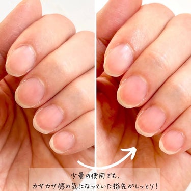 うるおい成分配合！つめ用美容液✨

◽️NAIL HOLIC リペア セラム
770円（税込）15g

LIPS様のキャンペーンに当選し、NAIL HOLIC様より頂きました！

11月16日に発売のつめ用の美容液。
ひと足先にお試しさせて頂きました。

爪をケアするアイテムってオイル系のイメージがありましたが、こちらはクリームタイプ。

ハンドクリームよりも密着力が高く若干重めな印象ですが、少量でもかなり伸びがよく米粒大くらいで片手は足りる感じでした。
なじませた後はベタつきはあまり気になりません！

カサカサ感が気になっていた指先もしっとり✨
セラミドが配合されているとのことで、爪にもセラミドでケアできることに感激しました😊

ハンドクリームでももちろん手指のケアはできますが、爪により使いやすいように特化したアイテムだと思います。

ミニサイズで持ち運びしやすいので、気になったときに手軽にケアできる点もいいなと思いました！

#PR #ネイルホリック
#nailholic #爪ケア #爪用美容液 #ネイルケア #リペアセラム #ハンドケアの画像 その2