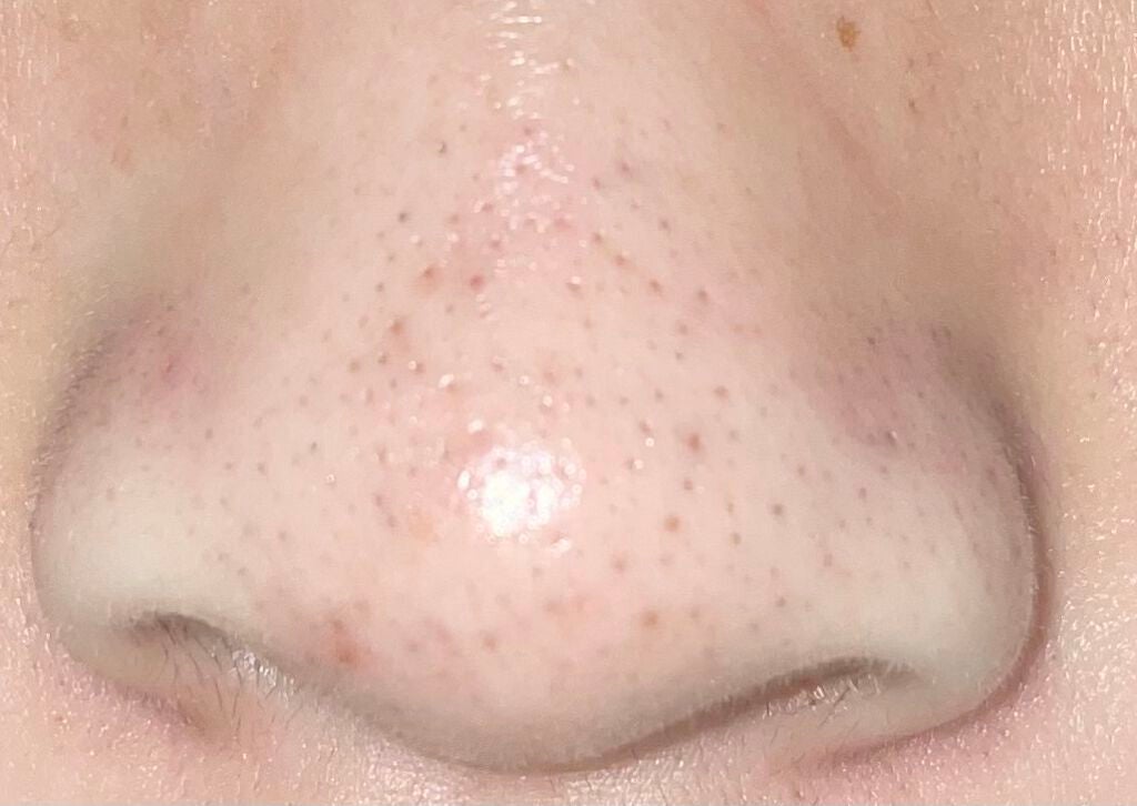 クレンジングバーム/ink./クレンジングバームを使ったクチコミ(1枚目)