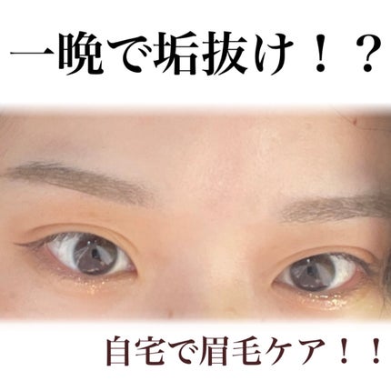 エピワックスシート /TBC/ムダ毛ケアを使ったクチコミ(1枚目)