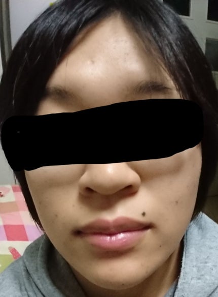 ミノン アミノモイスト 薬用アクネケア ローション/ミノン/化粧水を使ったクチコミ(4枚目)