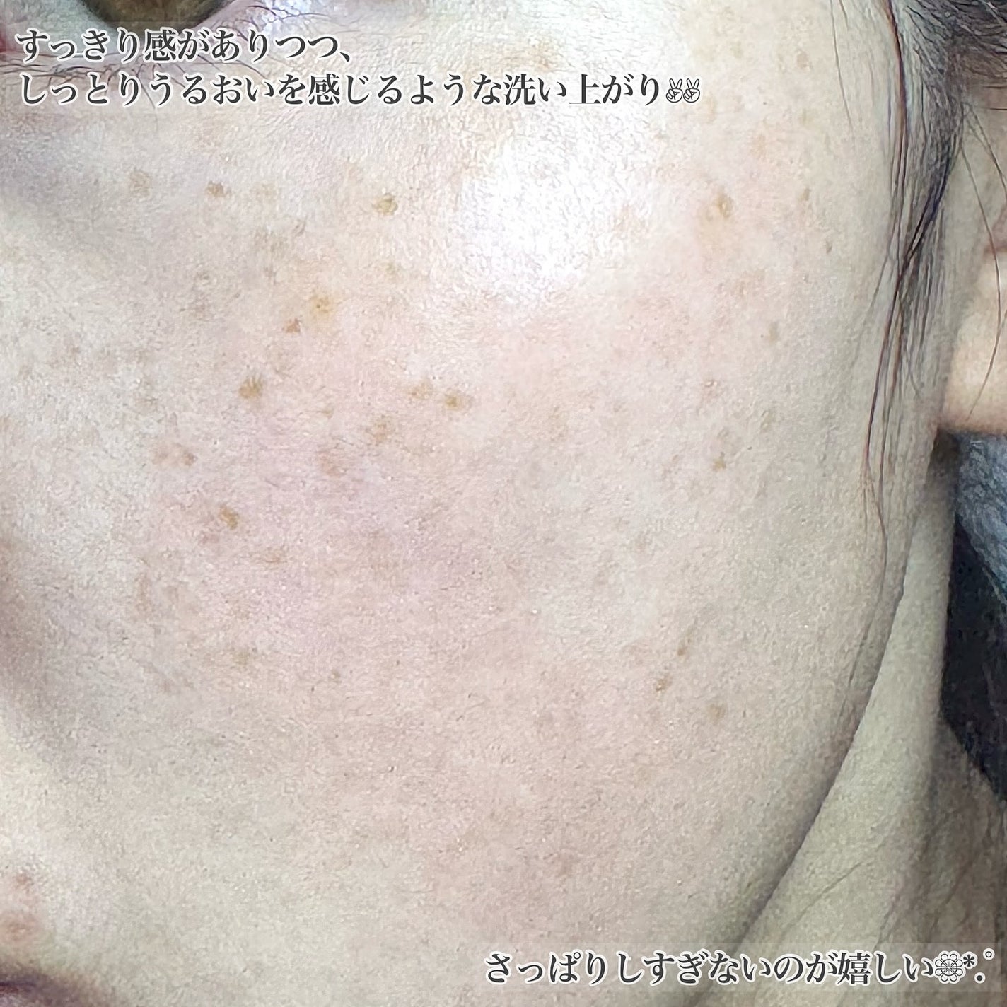 薬用VC泡フォーマー/VCシリーズ/洗顔フォームを使ったクチコミ(5枚目)