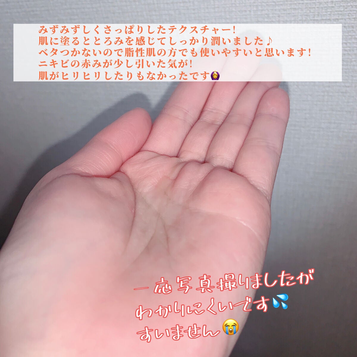 VC100エッセンスローション EX/ドクターシーラボⓇ/化粧水を使ったクチコミ(3枚目)