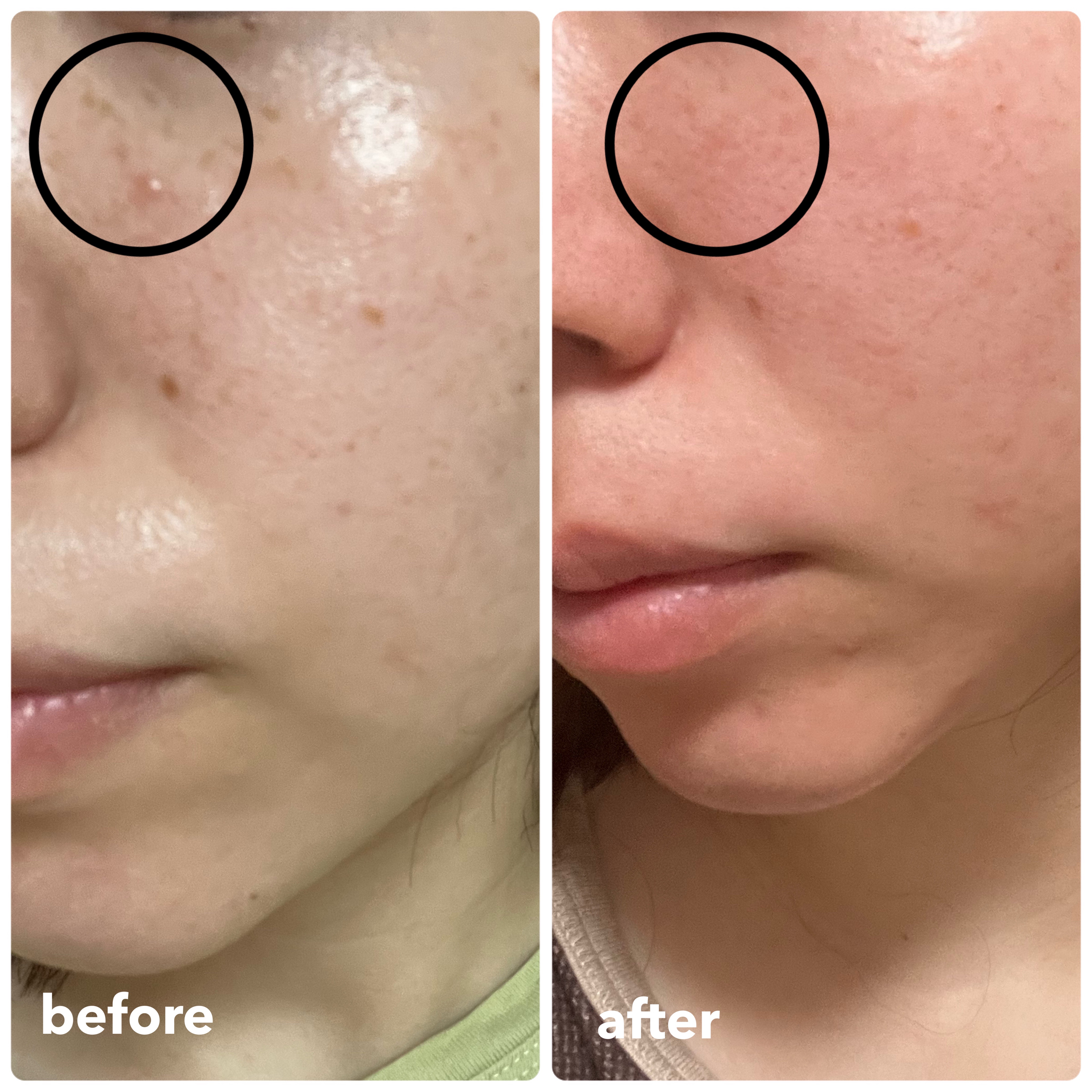 を使ったクチコミ（2枚目）