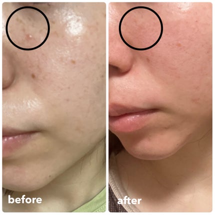 を使ったクチコミ(2枚目)