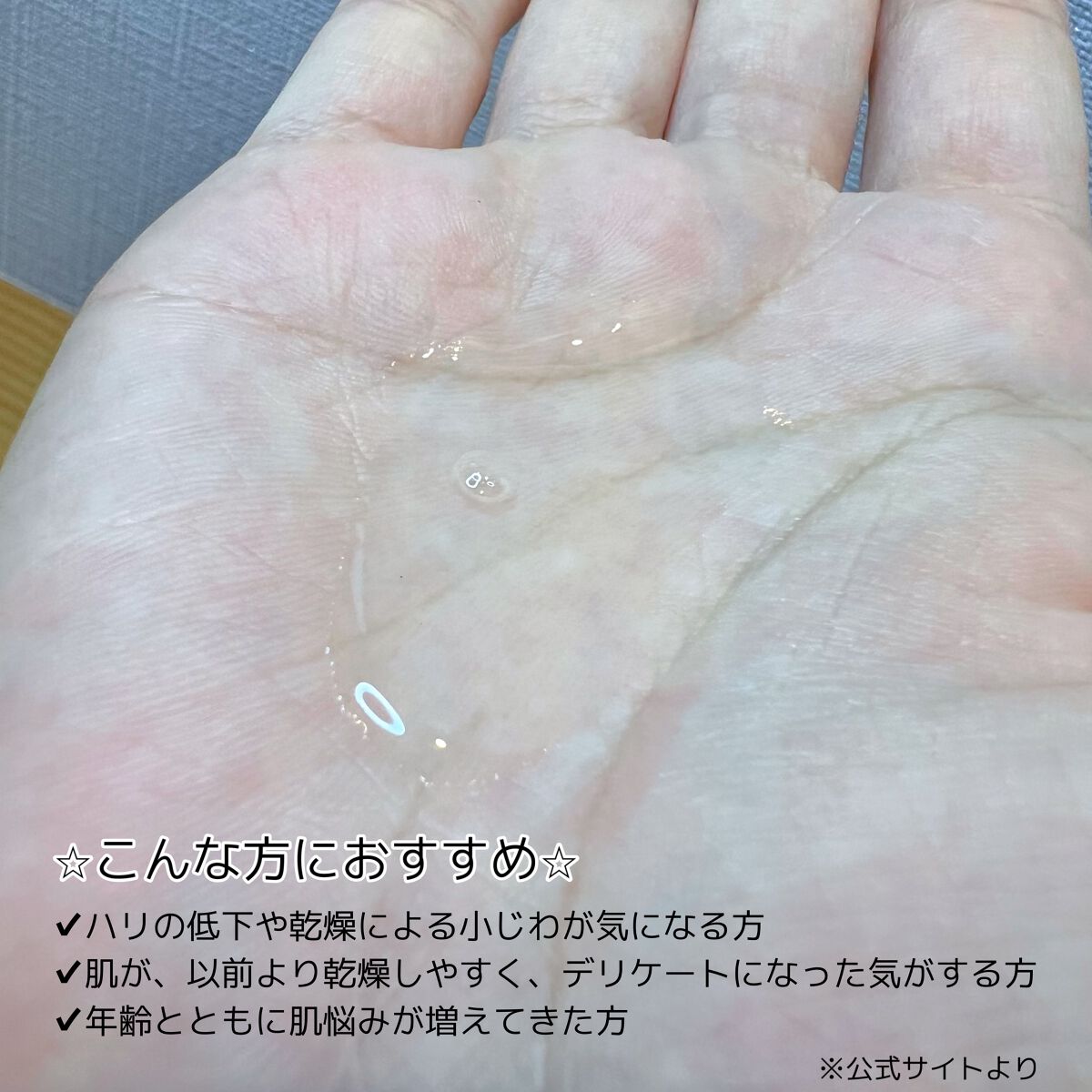 バイタルアクト ローション MB/d プログラム/化粧水を使ったクチコミ(3枚目)