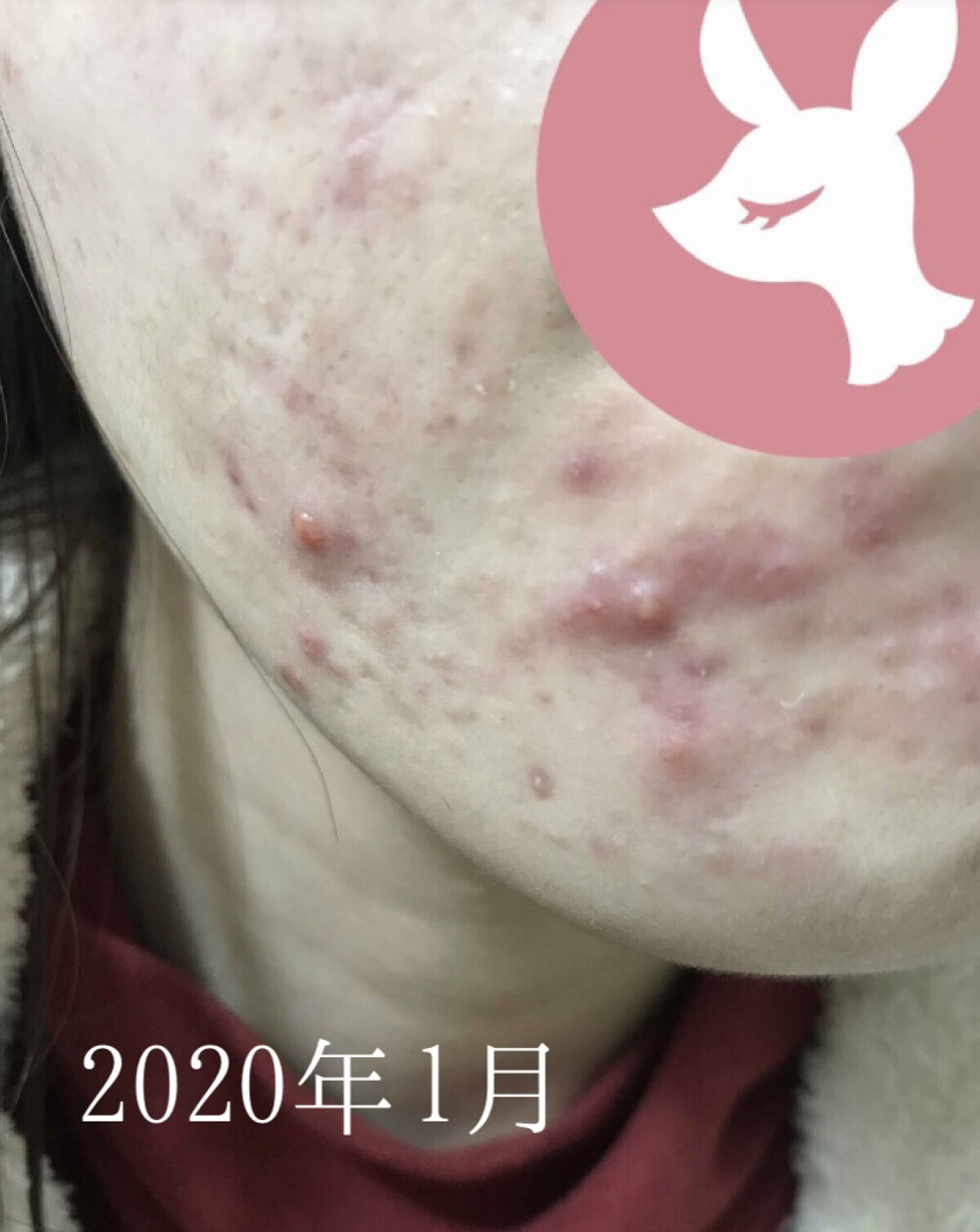 ティーツリーケア ソリューション エッセンシャルマスクEX/MEDIHEAL/シートマスク・パックを使ったクチコミ（2枚目）