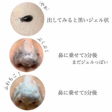 JUSO KURO PACK/NAKUNA-RE/洗い流すパック・マスクを使ったクチコミ（2枚目）
