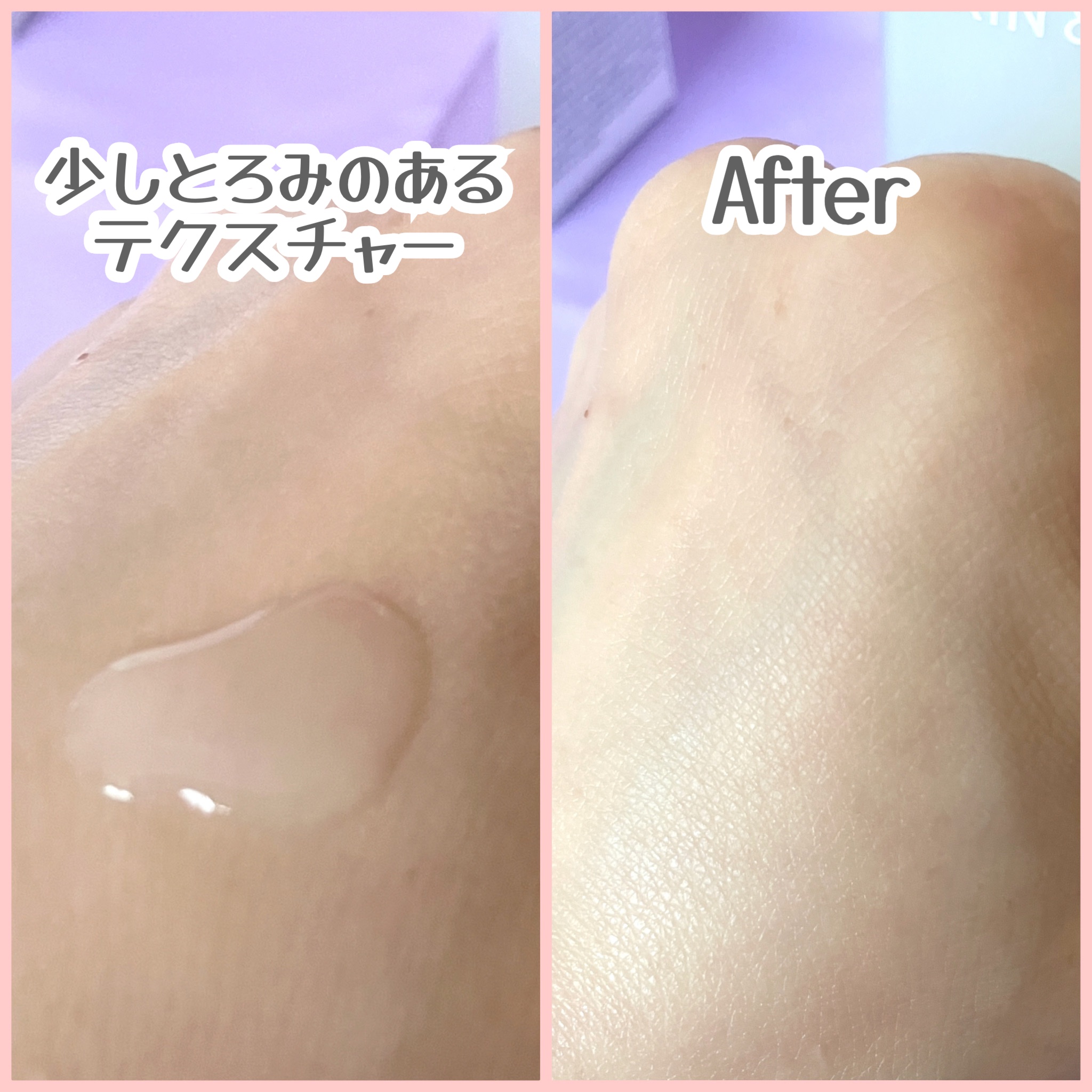 ヴィーガンリポソームレチノールセラム/SKIN&LAB/美容液を使ったクチコミ（3枚目）