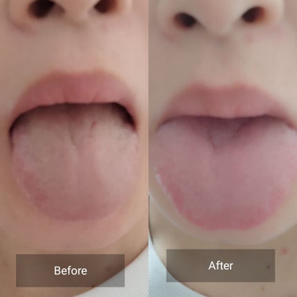 カムテクト/カムテクト/歯磨き粉を使ったクチコミ(4枚目)