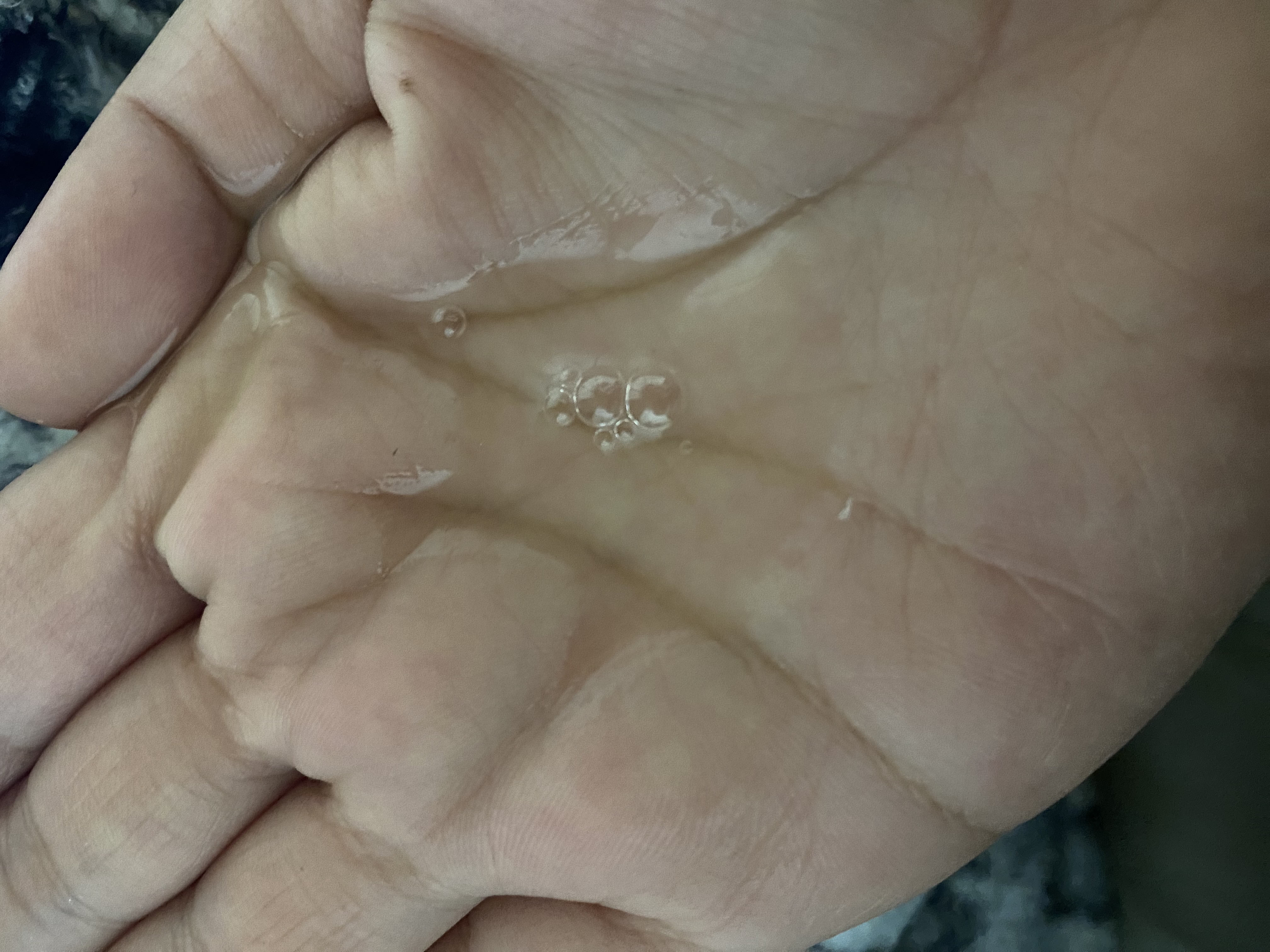 センテラ アンプル/SKIN1004/美容液を使ったクチコミ（2枚目）