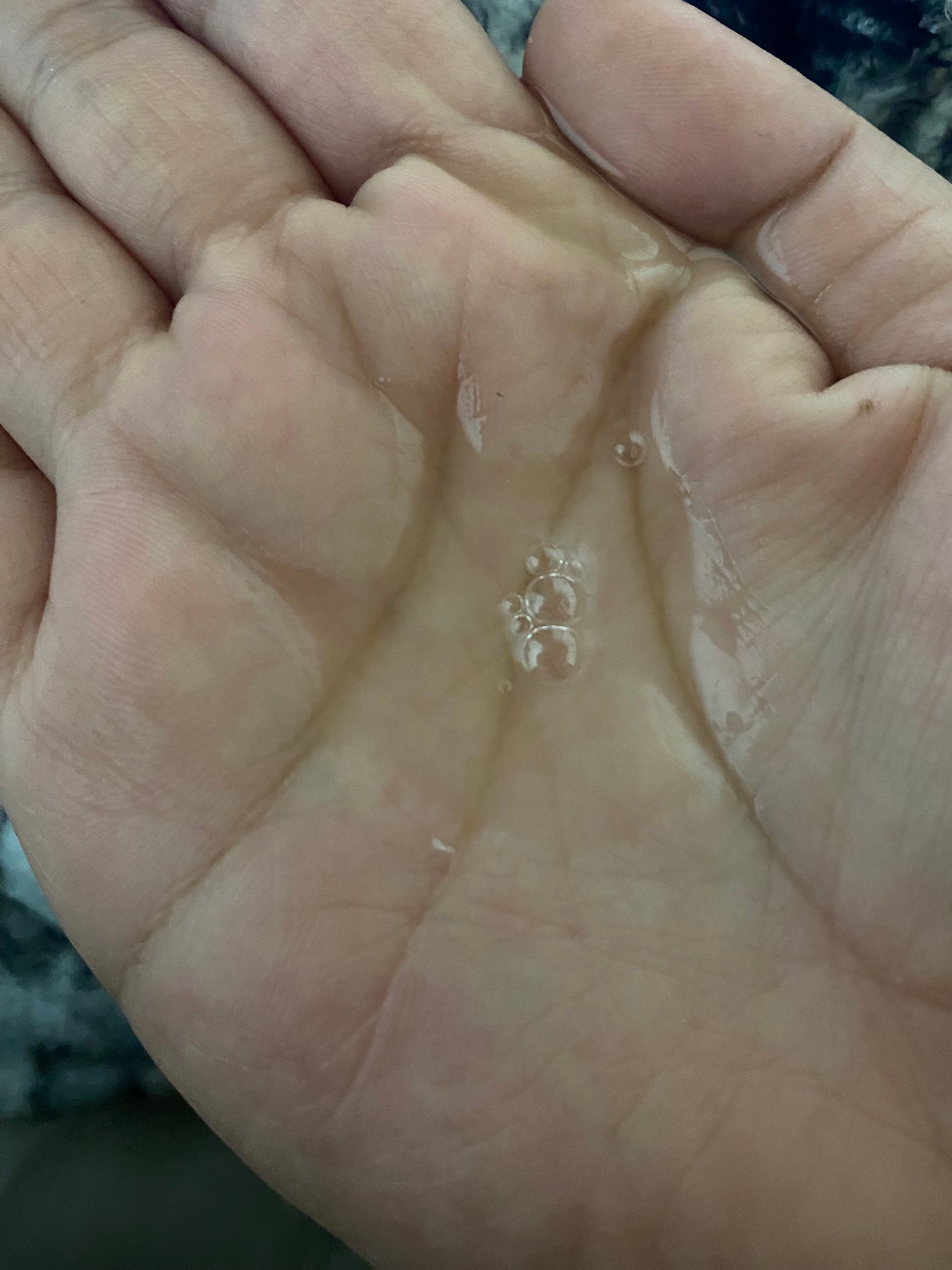 センテラ アンプル/SKIN1004/美容液を使ったクチコミ(2枚目)