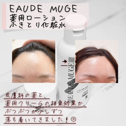 薬用スキンクリーム/オードムーゲ/フェイスクリームを使ったクチコミ(3枚目)