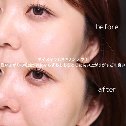 トリートメント クレンジング ミルク/COVERMARK/ミルククレンジングを使ったクチコミ(6枚目)