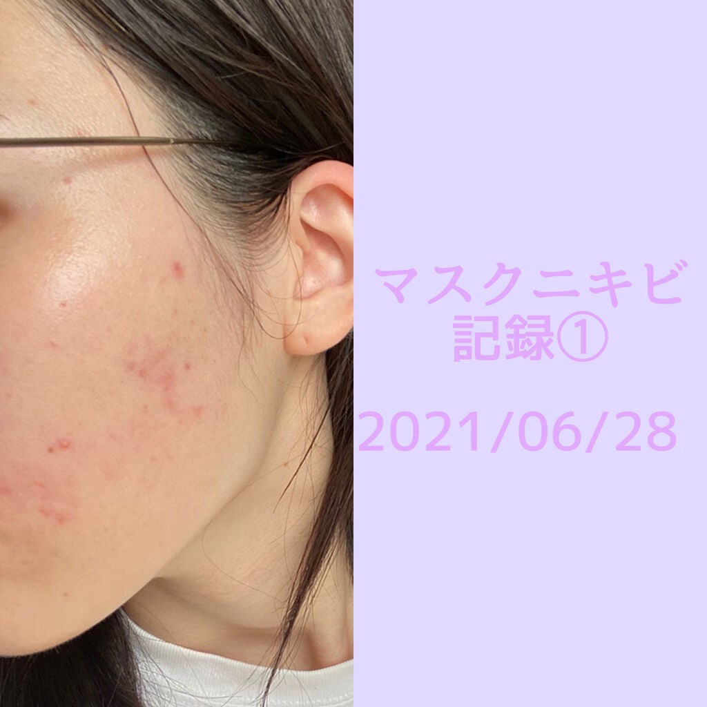 潤浸保湿 化粧水 III とてもしっとり/キュレル/化粧水を使ったクチコミ(1枚目)