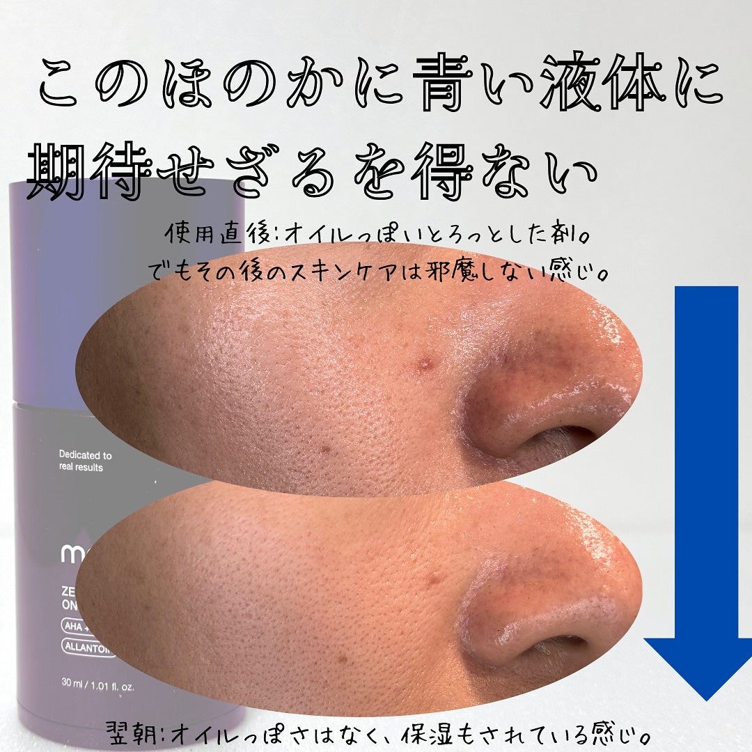 ゼロ毛穴1DAYセラム/MEDICUBE/美容液を使ったクチコミ(3枚目)