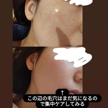 リードルショット100/VT/美容液を使ったクチコミ(3枚目)