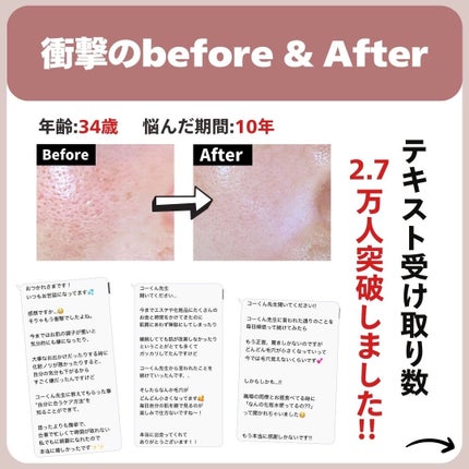 あなたの肌に合ったスキンケア💐コーくん先生 on LIPS 「【知らないとまじで損】エグいほど毛穴の開きが消える裏技..あな..」(8枚目)