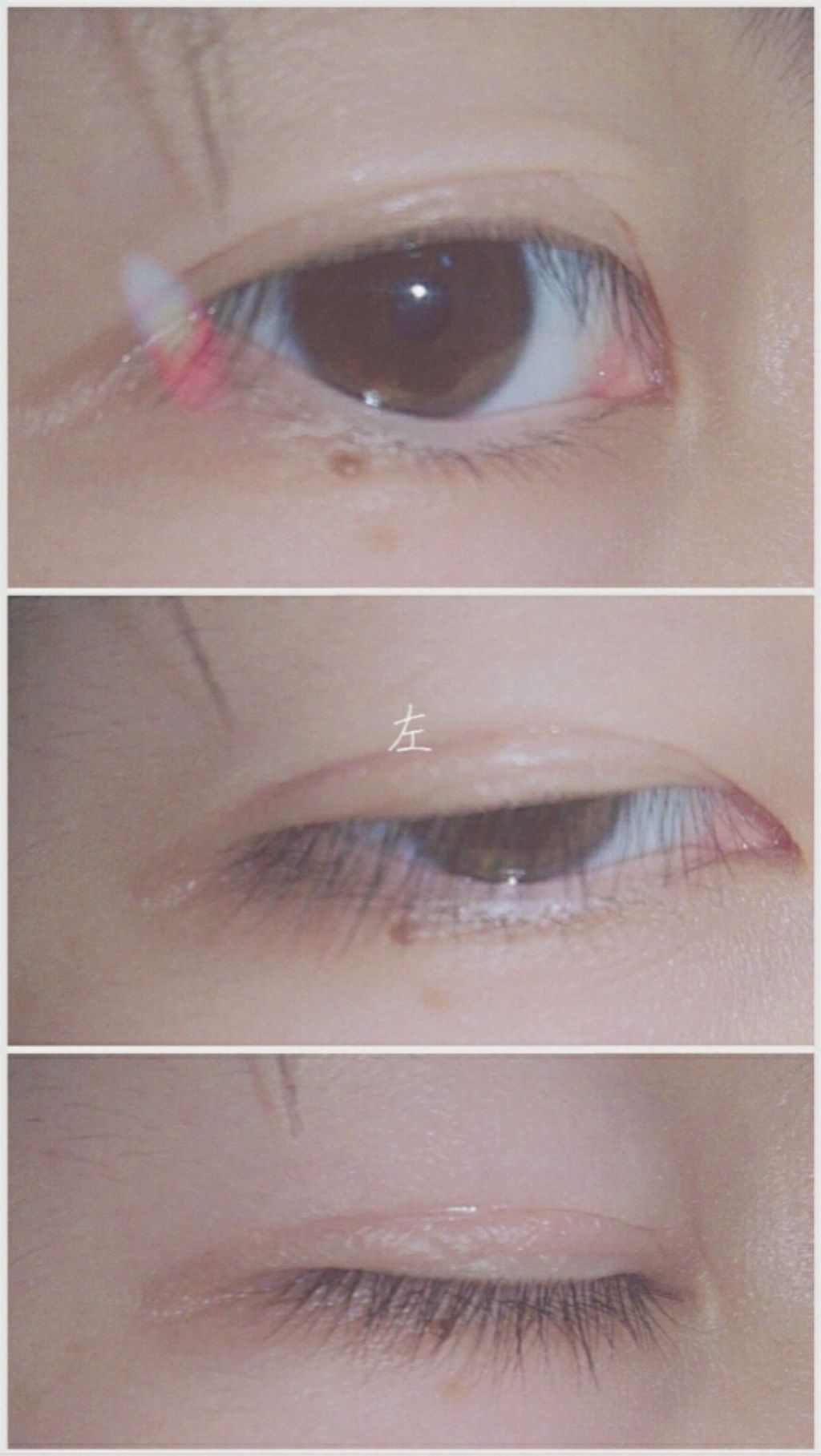 フリーファイバー120 スタンダードタイプ /メザイク/二重まぶた用アイテムを使ったクチコミ（3枚目）