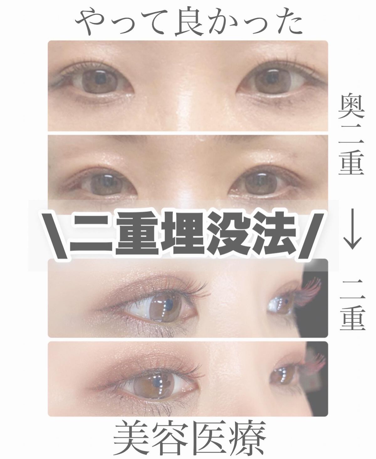 りっちゃん on LIPS 「土曜日の朝から目がたくさん出てきてすいません👀∞------..」(1枚目)