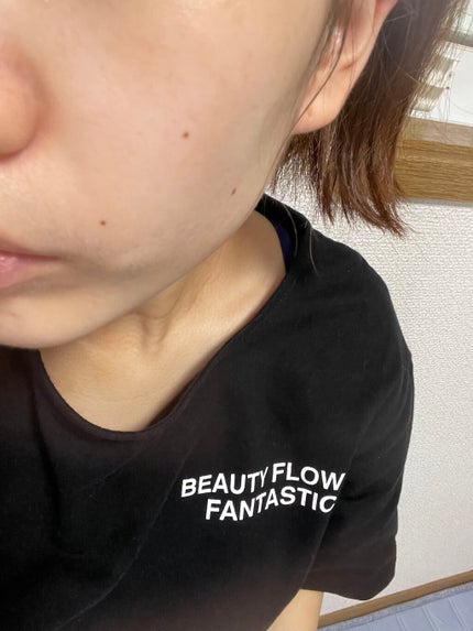 Wエッセンス/shimaboshi/美容液を使ったクチコミ(4枚目)