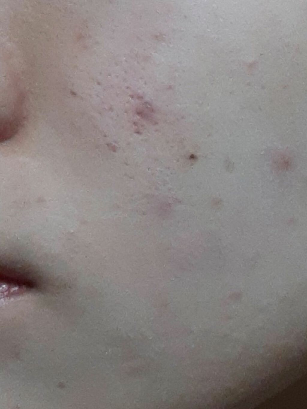 モイストピュアカラーリップ/ニベア/リップクリームを使ったクチコミ（2枚目）