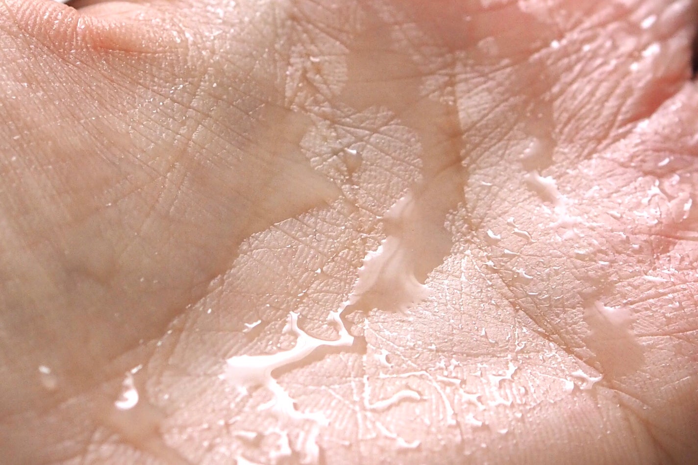 Dr.ウィラード・ローズウォーター/Dr.ウィラード・ウォーター/化粧水を使ったクチコミ(6枚目)