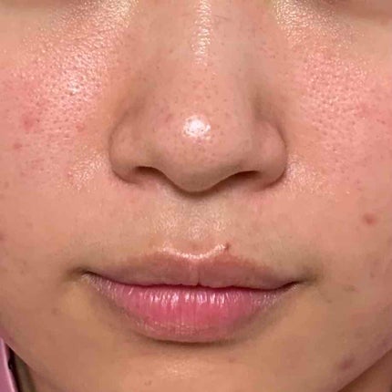 クリアウォッシュ/オルビス/洗顔フォームを使ったクチコミ(4枚目)