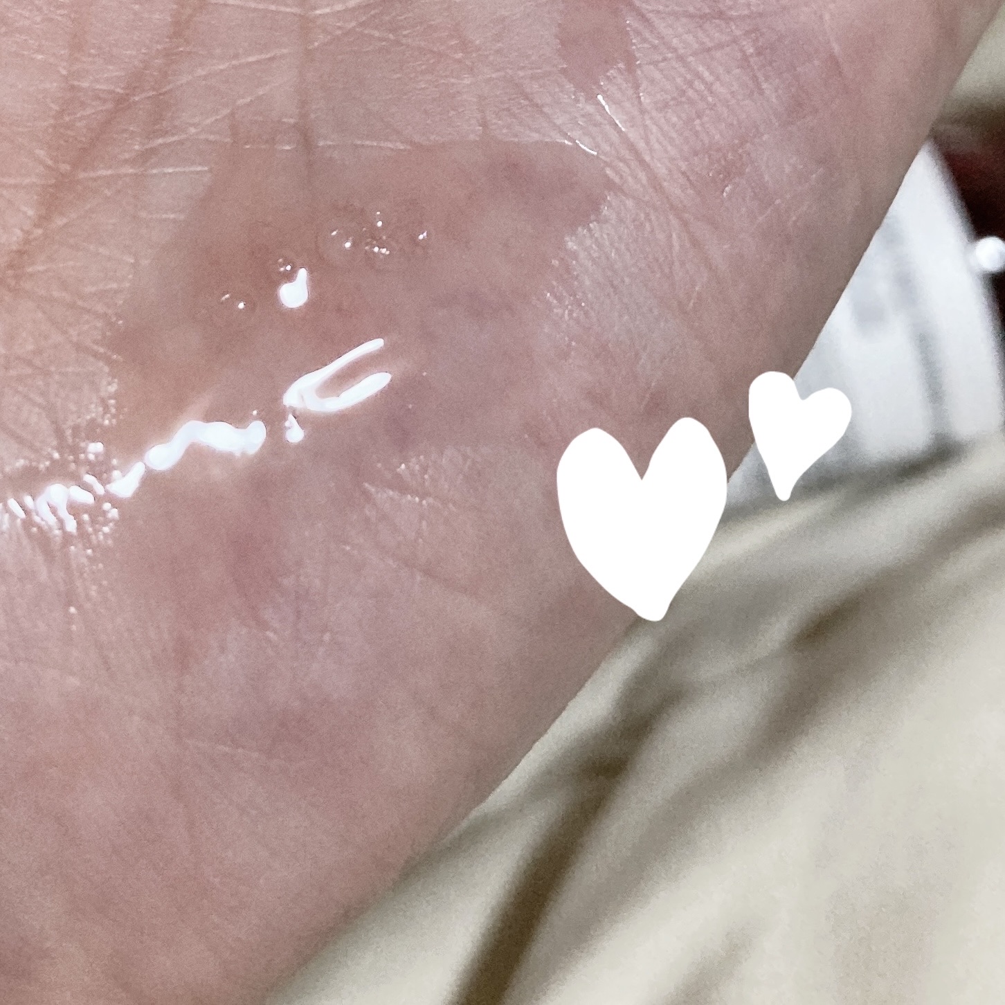 ヒアルサン アクアタイド4.0アンプル/ISCHIA/美容液を使ったクチコミ（2枚目）