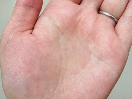 フォルテ アンプル トリートメント/treecell/洗い流すヘアトリートメントを使ったクチコミ(3枚目)