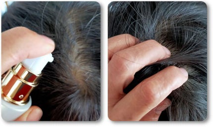 薬用スカルプ美容液スカルシア/スカルシア/頭皮トリートメントを使ったクチコミ(1枚目)